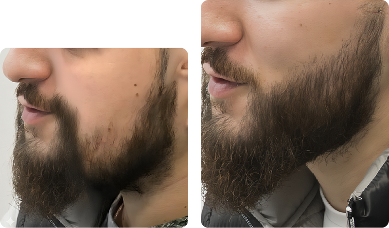 Beard Benefits That Go Beyond Cleaning